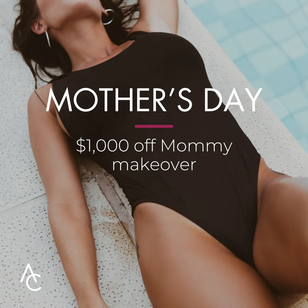 Mother's Day Mommy Makeover Special - May 2024