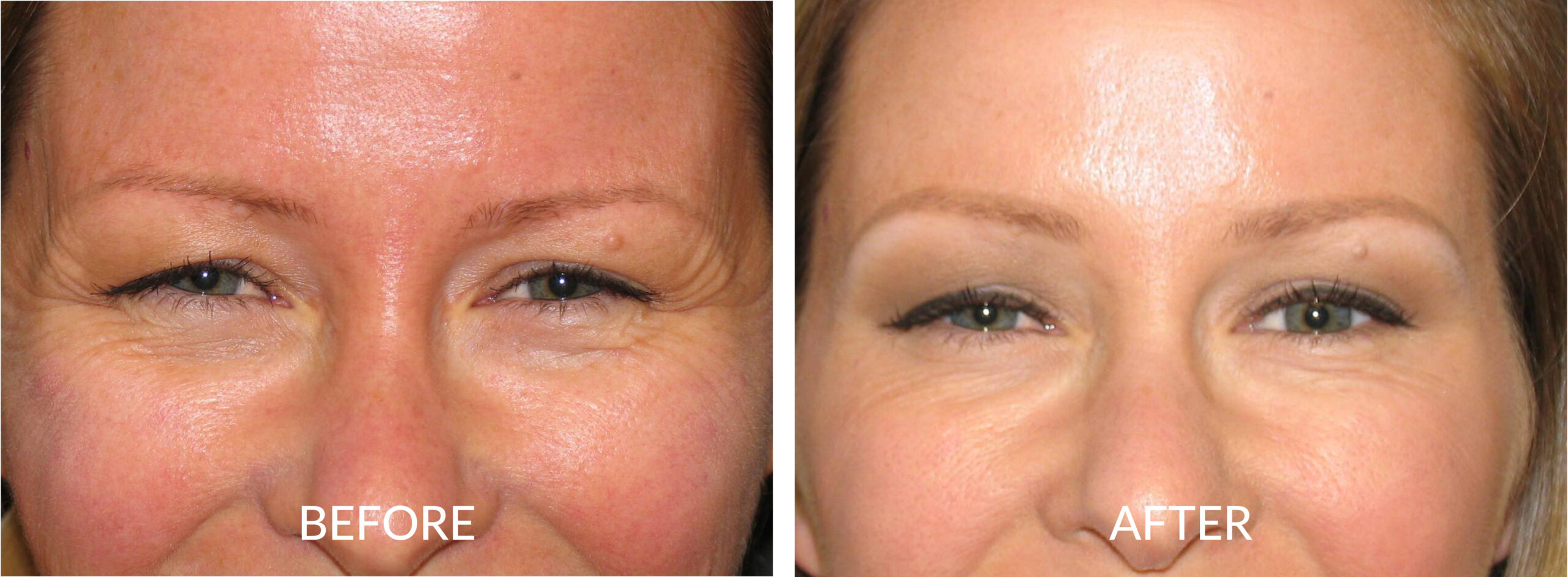 Cosmetic Injectables